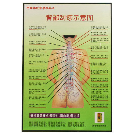 G-06A2 Acupuncture Hand Chart