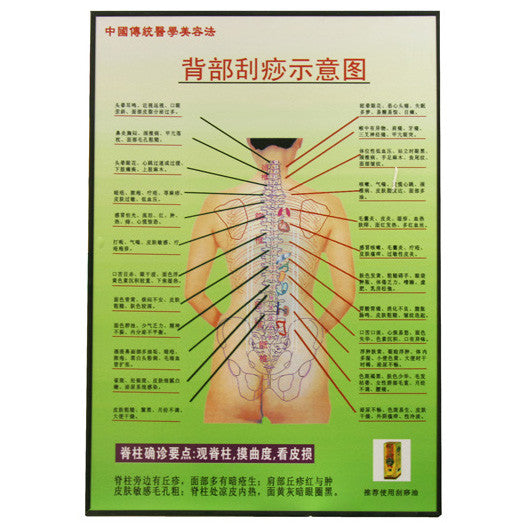G-06A2 Acupuncture Hand Chart - Acubest